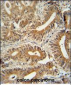 CCDC123 Antibody (C-term)